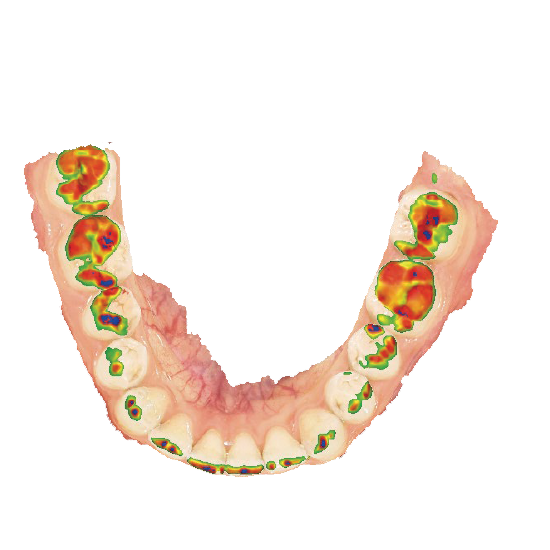 Máy quét trong miệng Aoralscan Elf