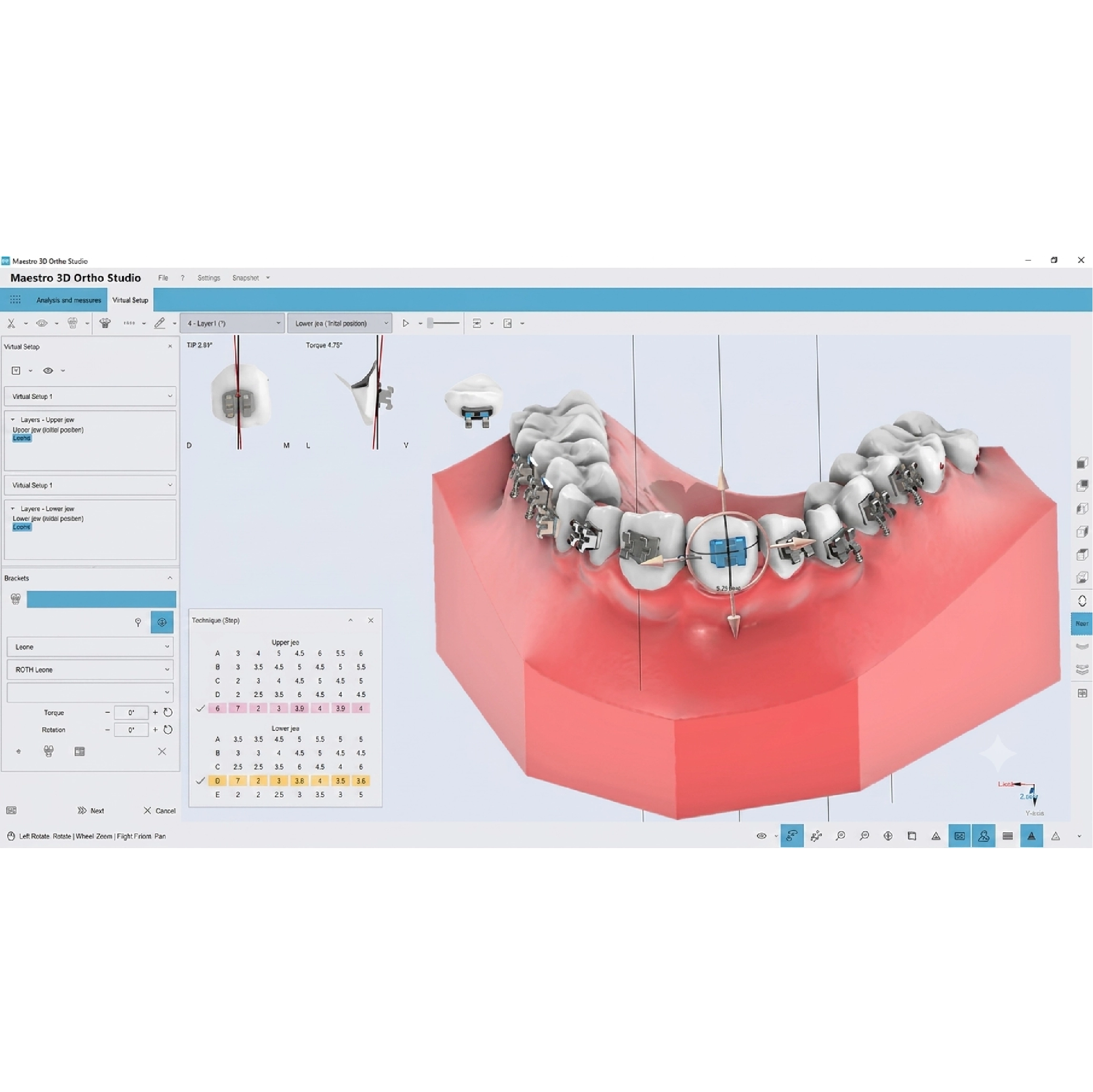 Phần Mềm Chỉnh Nha Maestro 3D