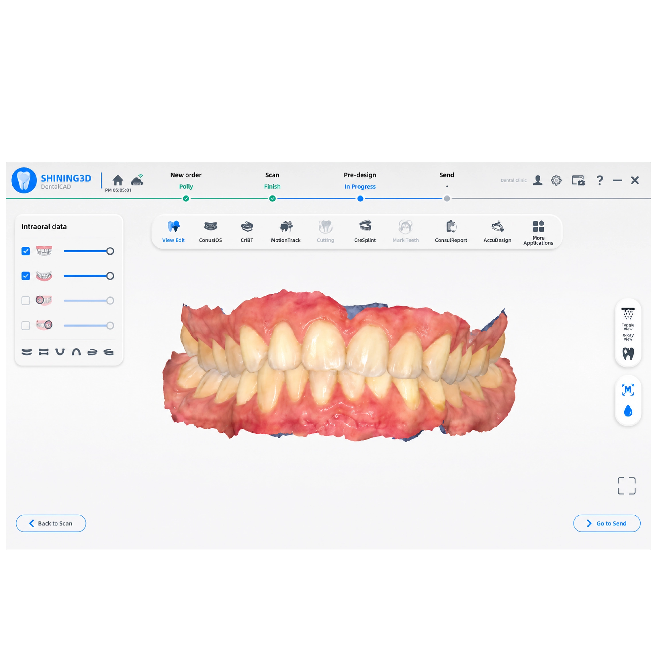 Phần Mềm Máng Gắn Mắc Cài Gián Tiếp CreIBT